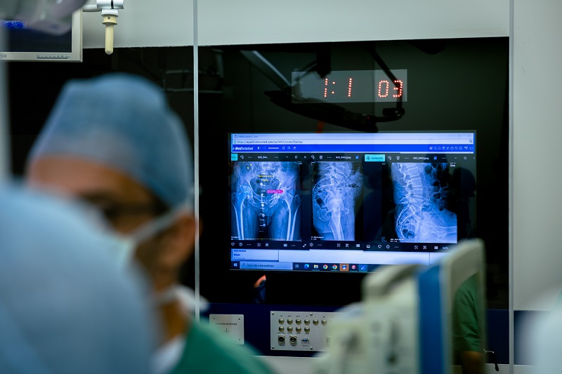 robotasszisztált csípőprotézis-műtét